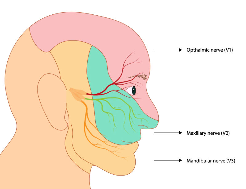 글 "삼차 신경통 초기 증상과 대처 방법"의 이해를 돕기 위한 이미지 : 삼차신경 그림. 인간 얼굴의 측면을 보여주는 그림으로, 삼차신경의 세 가지 주요 분지(안신경, 상악신경, 하악신경)가 얼굴의 각 영역으로 뻗어 있는 모습을 설명. 안신경(V1)은 이마와 눈 주위로, 상악신경(V2)은 뺨과 코 주위로, 하악신경(V3)은 턱과 아래턱으로 연결됨을 표시.